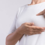 El cáncer de mama inflamatorio puede avanzar rápidamente y a menudo no presenta un bulto como señal de alerta